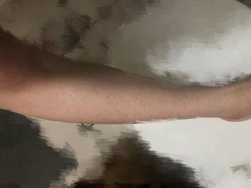 美白身体乳可以和果酸身体乳一起用吗