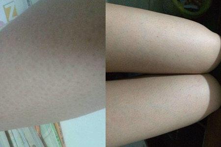 人变动物的鸡皮疙瘩小说