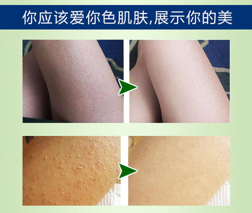 多芬身体乳涂脸