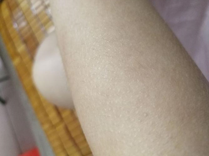 狗狗身上有个红点 然后掉毛