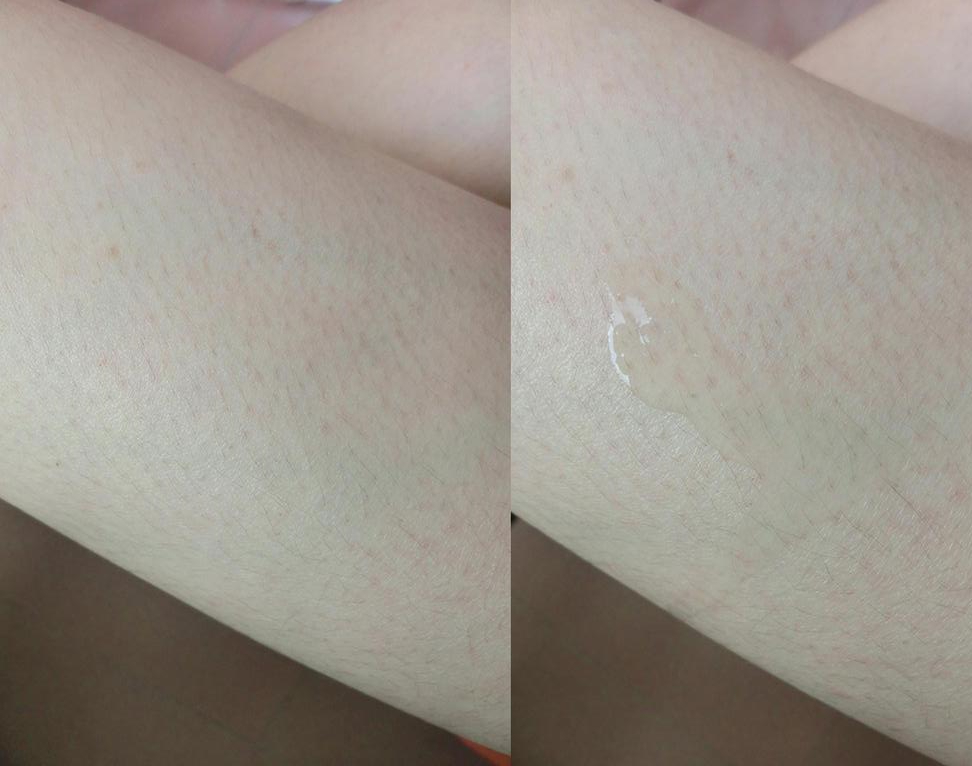 为什么我的鸡皮肤比别人颜色深